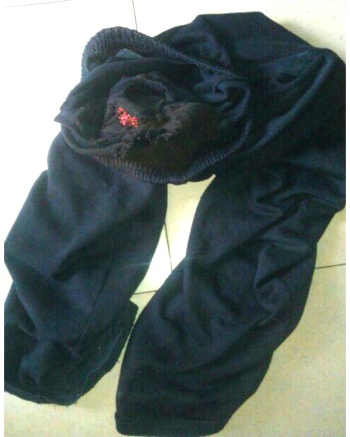 המכנסיים המפויחות של אורין