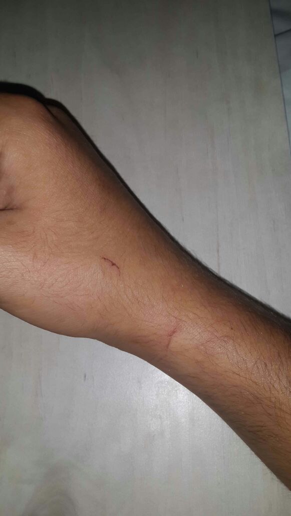 החבלות על היד. /File/334965